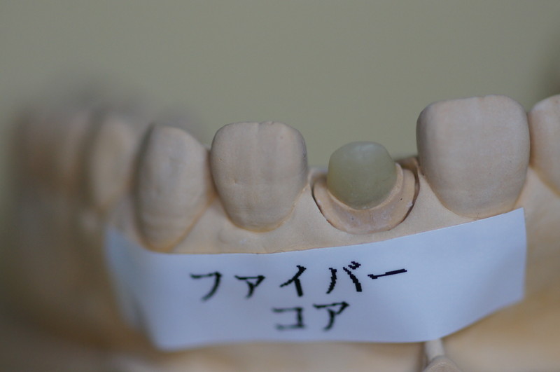 ファイバーコア